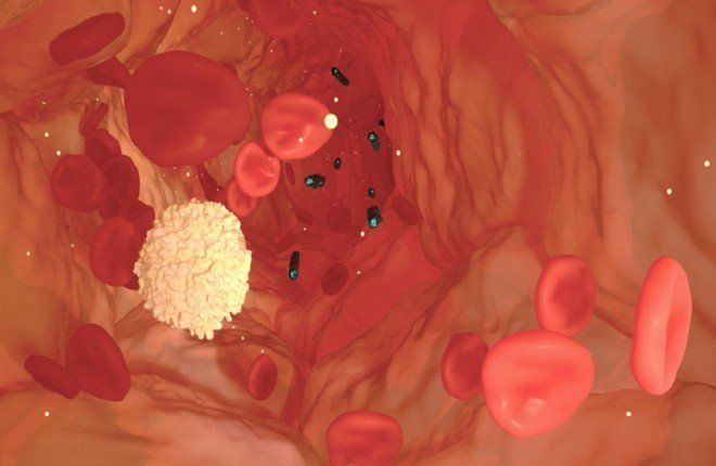 دواء جديد لعلاج الإنتان يحقق نتائج واعدة في المرحلة الثانية من التجارب السريرية