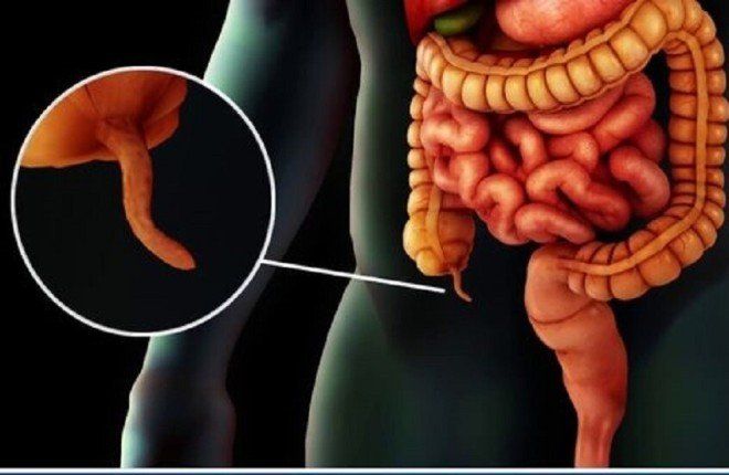 الدور الخفي للزائدة الدودية: أكثر من مجرد عضو "زائد" في الجسم