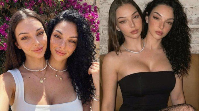 شاهد .. الحقيقة صادمة.. ما قصة التوأم الملتصق فاليريا وكاميلا التي أشعلت مواقع التواصل؟