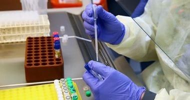 جامعة الأمير محمد بن فهد ضمن قائمة أفضل 100 جامعة عالميا فى براءات الاختراع