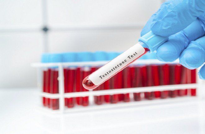 طبيب يحذر: قلة النوم تخفض هرمون الذكورة أسرع من الشيخوخة الطبيعية