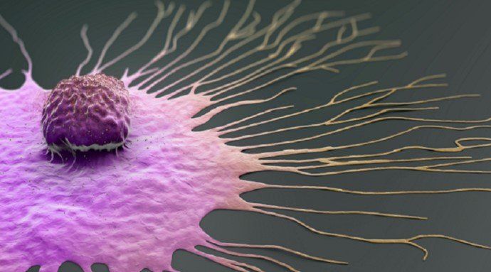 دواء واعد يستهدف سرطان الثدي الفصيصي الغازي ويبطئ انتشاره