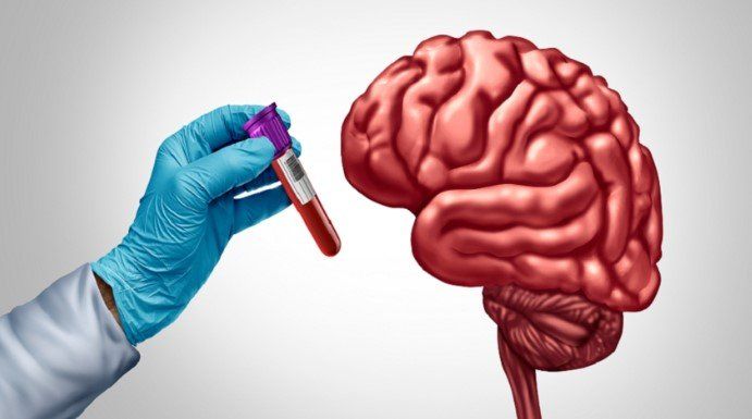 فحص دم جديد يتنبأ بخطر الإصابة بالخرف لدى النساء قبل 25 عامًا من ظهور الأعراض