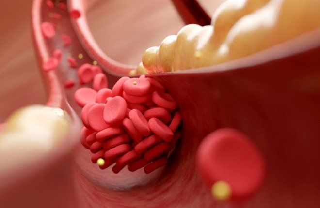 دواء فموي جديد يخفض الكوليسترول الضار بنسبة تصل إلى 60% ويعزز آمال الوقاية من أمراض القلب