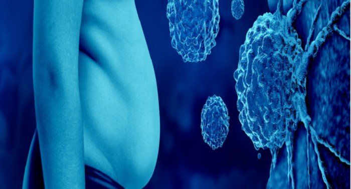 دراسة ألمانية تحذر: السمنة تزيد خطر السرطان أكثر مما نعتقد