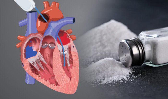 دراسة.. الإفراط في تناول الصوديوم يزيد خطر الإصابة بقصور القلب