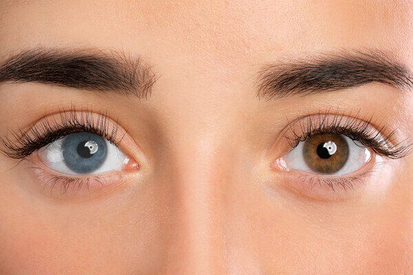 تغيرات قزحية العين قد تكشف أمراضًا خطيرة بينها تلف الجهاز العصبي وأورام جلدية