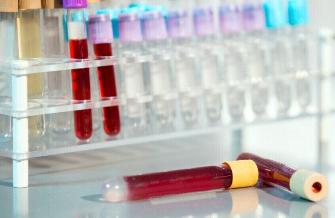 دراسة: فقر الدم قد يكون مؤشراً مبكراً وخفياً على الإصابة بالسرطان