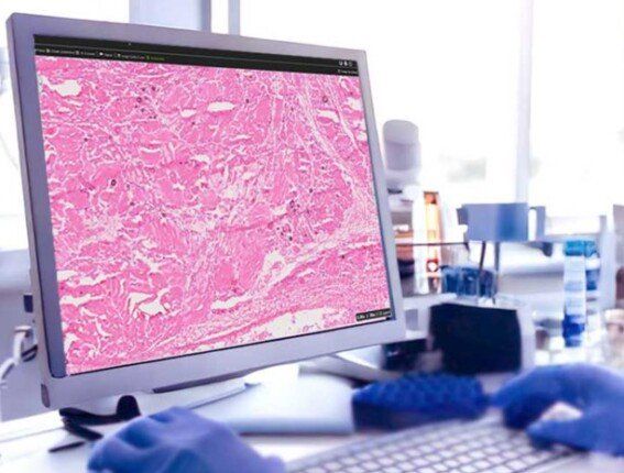 باحثون يطورون مجهرا ثلاثي الأبعاد يرصد أنسجة بشرية بدقة عالية