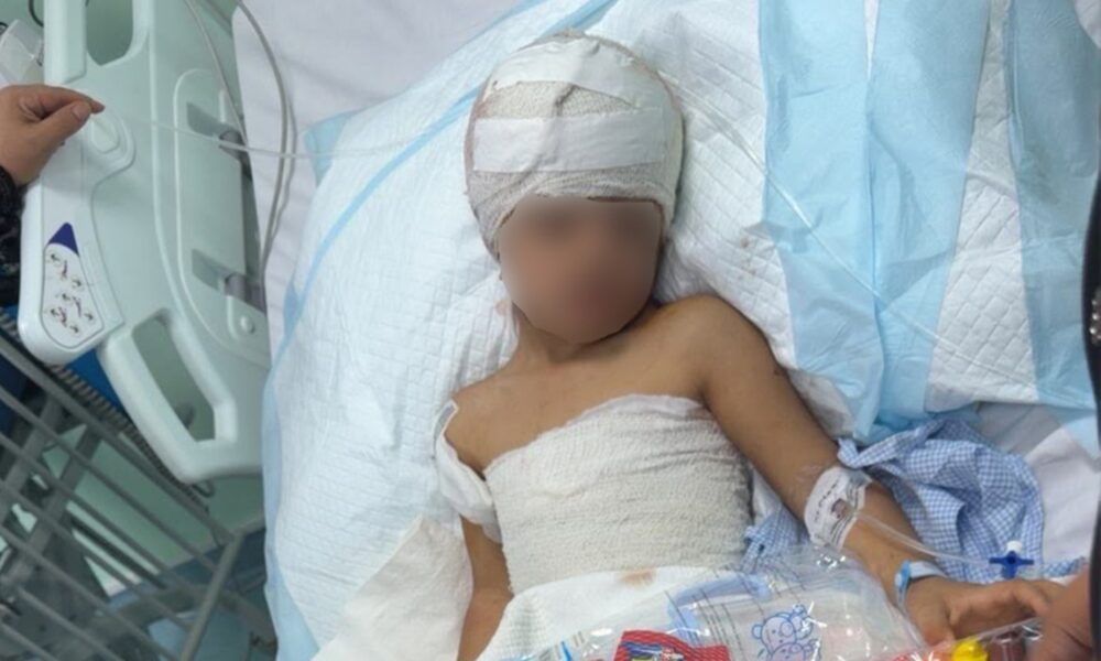 نجاة طفل من هجوم الكلاب الضالة في طريف: تفاصيل الحادثة