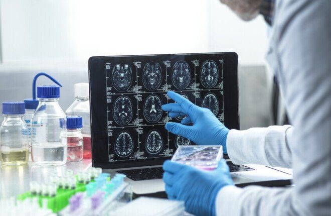 اكتشاف علمي يوضح آلية تلف الأوعية في مرض ألزهايمر ويفتح آفاق علاجية جديدة