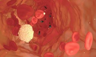 دواء جديد لعلاج الإنتان يحقق نتائج واعدة في المرحلة الثانية من التجارب السريرية