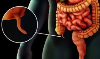 الدور الخفي للزائدة الدودية: أكثر من مجرد عضو "زائد" في الجسم