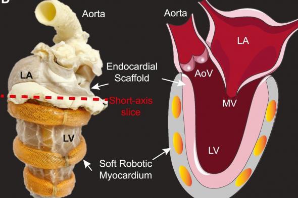 إنجاز علمي كبير.. تطوير جهاز محاكاة لصمام القلب لدراسة اضطرابات القلس التاجي