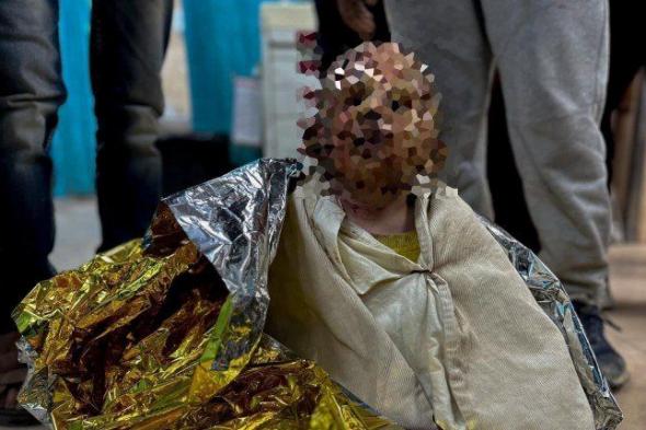 شاهد .. انقذوا سجى.. قصة طفلة فلسطينية أحرق الاحتلال وجهها