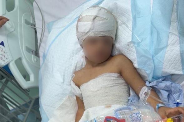 نجاة طفل من هجوم الكلاب الضالة في طريف: تفاصيل الحادثة